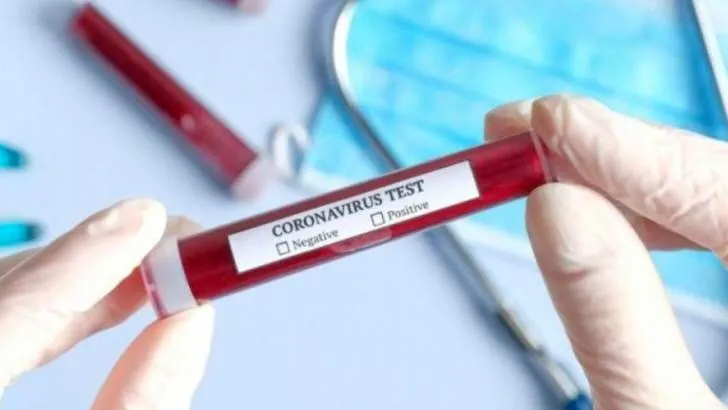 Joi au ajuns în România cele 200.000 de teste PCR pentru identificarea bolnavilor de coronavirus. Dispozitivele medicale au fost trimise de Coreea de Sud, ca ajutor în această situație de criză globală.