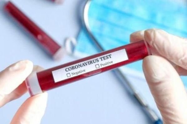 Joi au ajuns în România cele 200.000 de teste PCR pentru identificarea bolnavilor de coronavirus. Dispozitivele medicale au fost trimise de Coreea de Sud, ca ajutor în această situație de criză globală.
