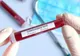 Joi au ajuns în România cele 200.000 de teste PCR pentru identificarea bolnavilor de coronavirus. Dispozitivele medicale au fost trimise de Coreea de Sud, ca ajutor în această situație de criză globală.